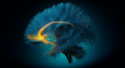 Next-Gen Brain Implants Offer New Hope for Depression