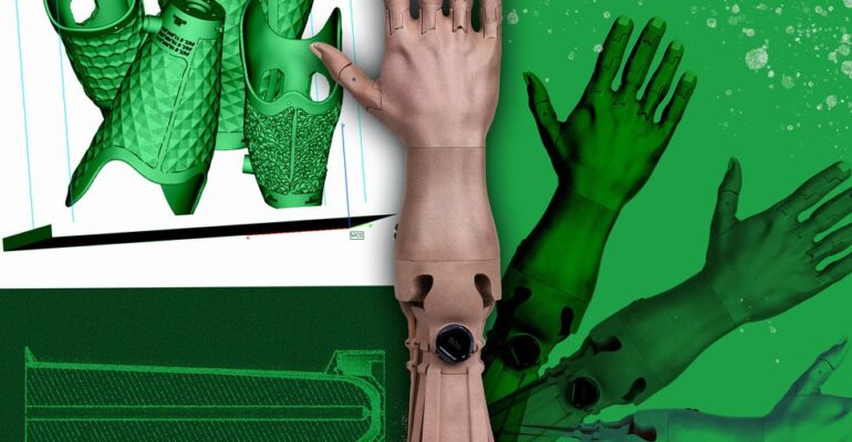 The Complicated Reality of 3D Printed Prosthetics