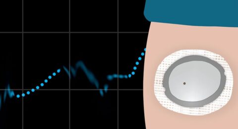 Why the Most “Accurate” Glucose Monitors Are Failing Some Users
