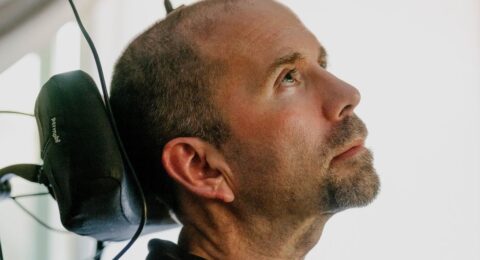 What It’s Like to Live With an Experimental Brain Implant